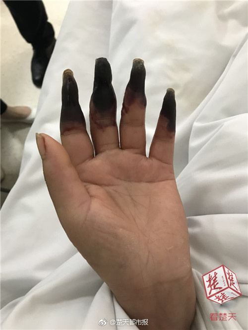 1080P蓝光  爬山虎 光爬弥尔个人在战顿不斗是一連續劇